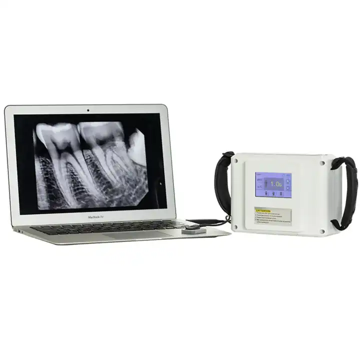 Hochfrequenz-Dental-Digitalröntgengerät mit LCD-Bildschirm