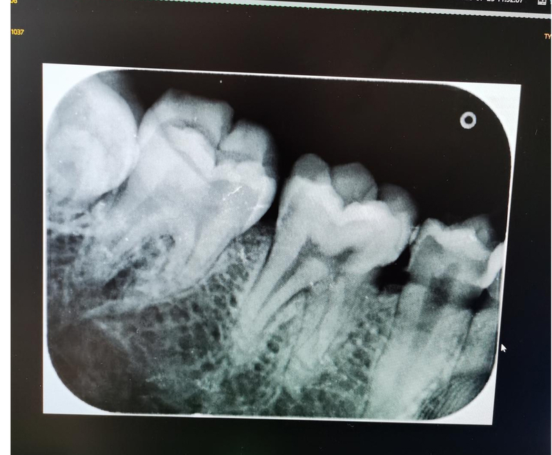 Dentales wandmontiertes Röntgengerät